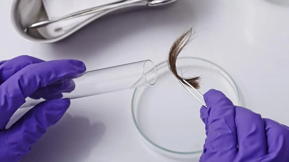 Teste Toxicológico - Detecção de drogas